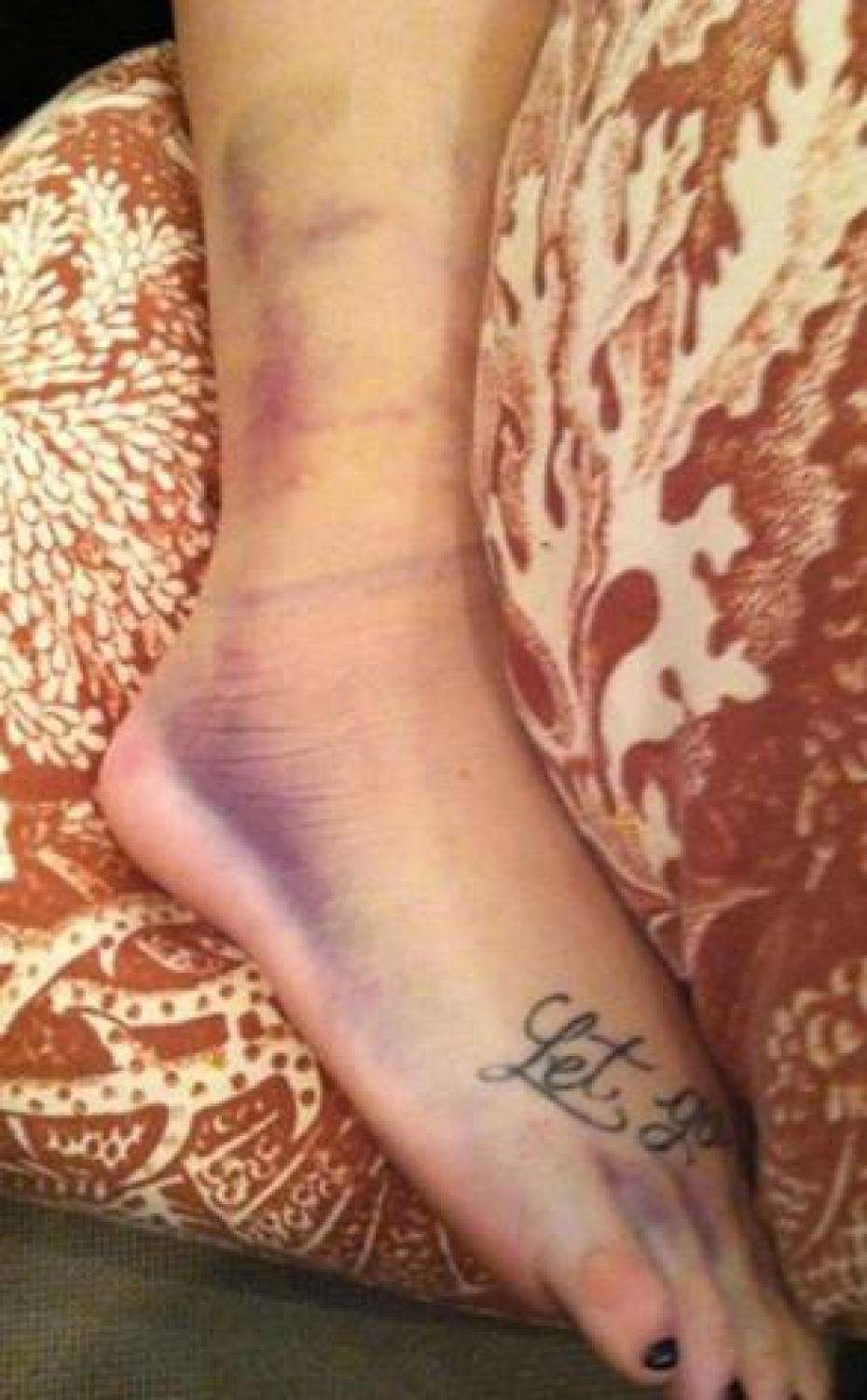 Il piede di Demi Lovato