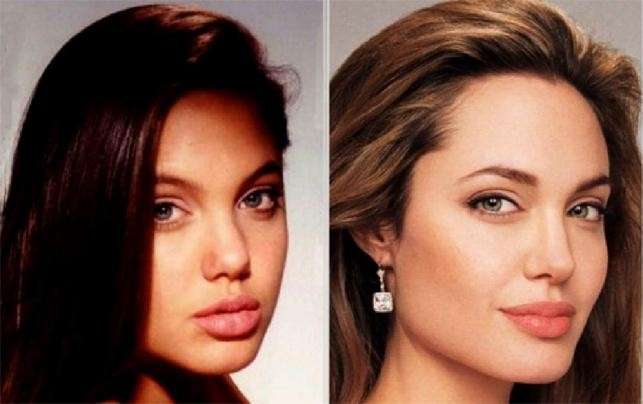 Angelina Jolie ha rifatto il naso