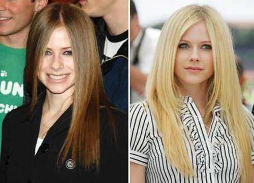 Avril Lavigne prima e dopo la rinoplastica