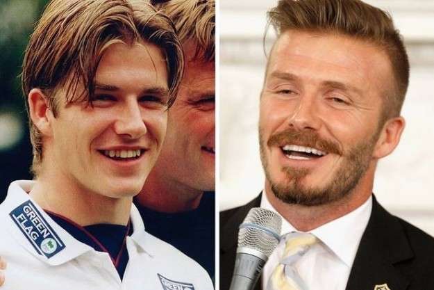 David Beckham prima e dopo 