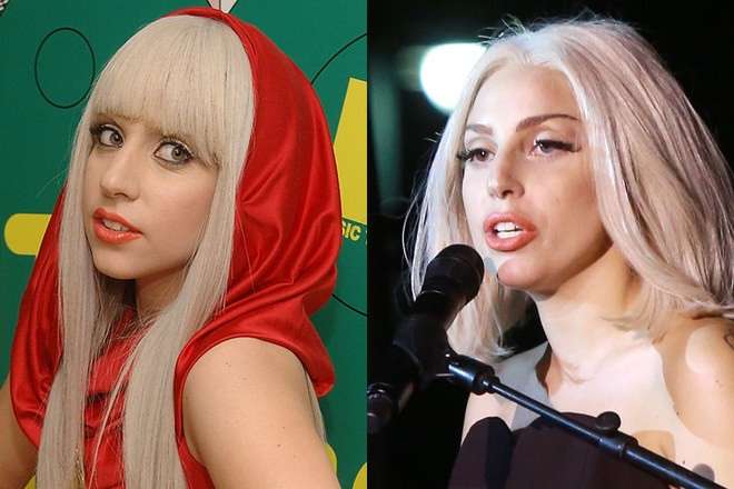 Lady Gaga ha rifatto il naso