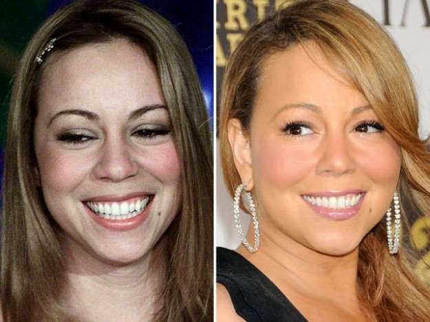 Mariah Carey e la rinoplastica
