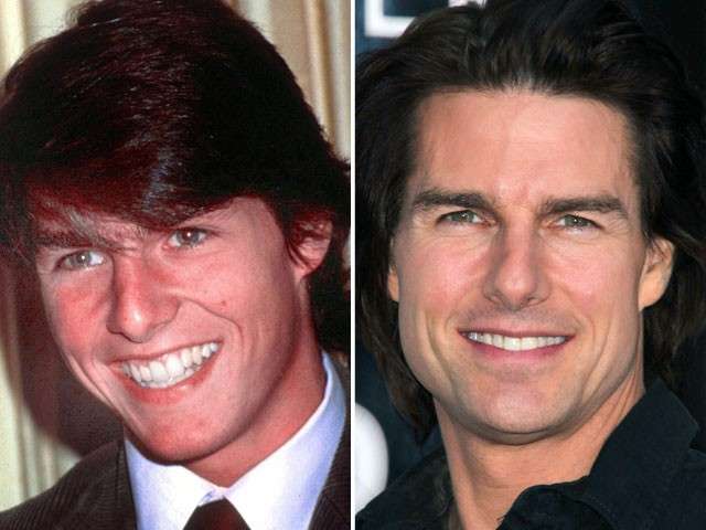 Tom Cruise e il naso nuovo