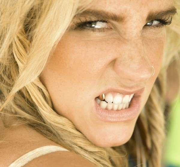 Kesha con il dente d'oro