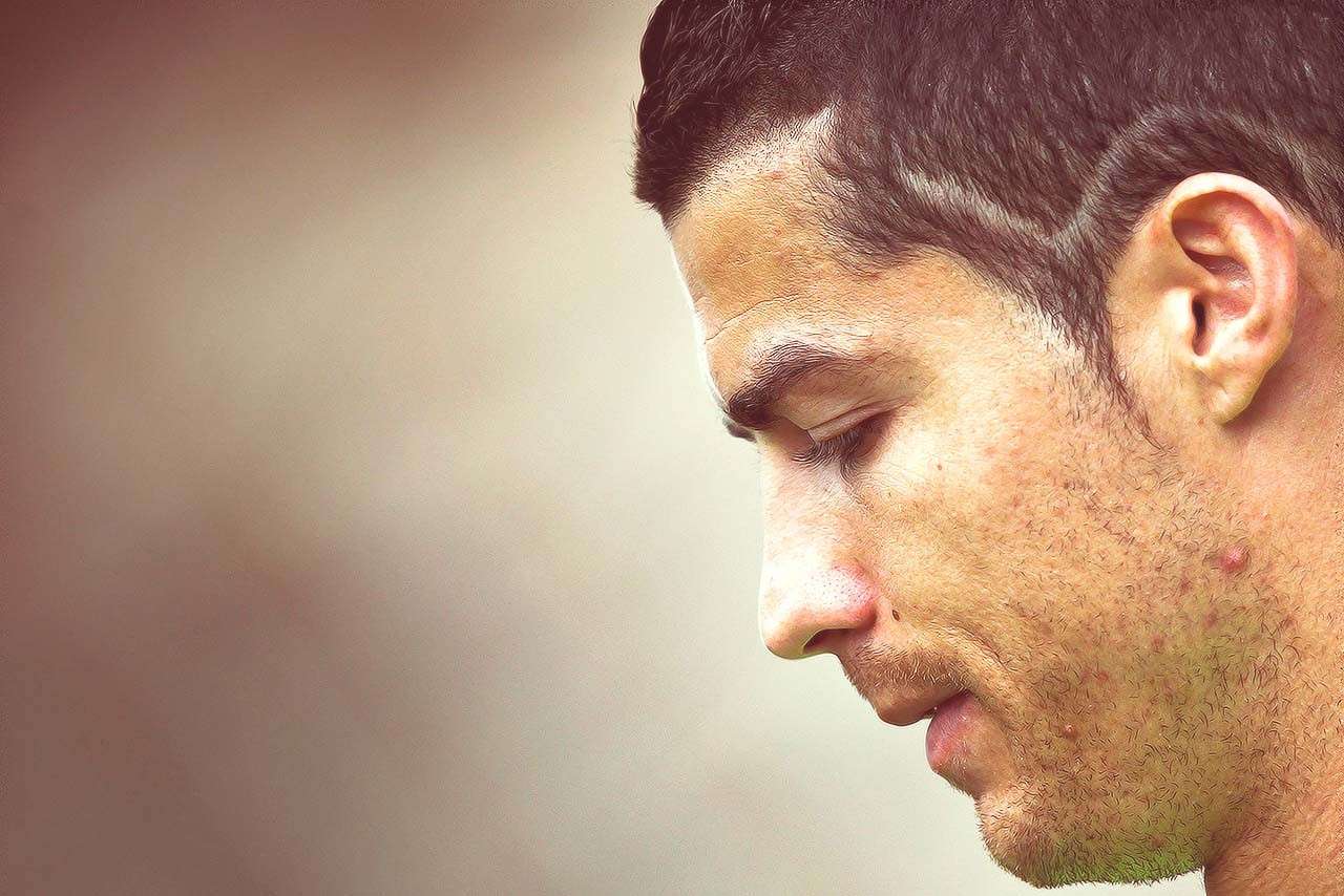 Acne cristiano ronaldo