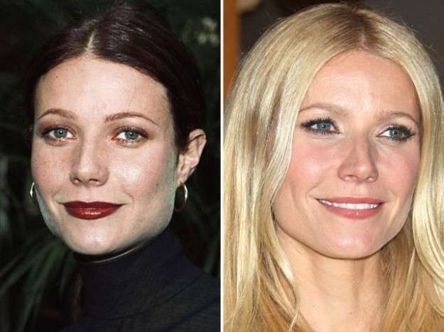 Gwyneth Paltrow dopo la rinoplastica