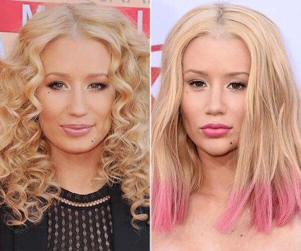 Iggy Azalea prima e dopo